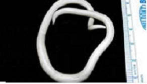 Giun đũa Ascaris lumbriocoides trưởng thành